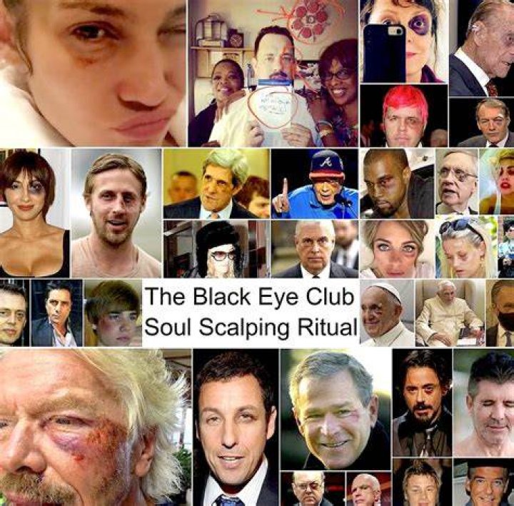 Black Eye Club Members: The Inside Scoop on This Elite Group