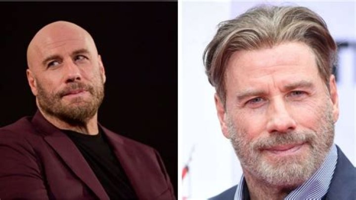 Did John Travolta Have a Stroke? Exploring the Facts and Clearing the Myths