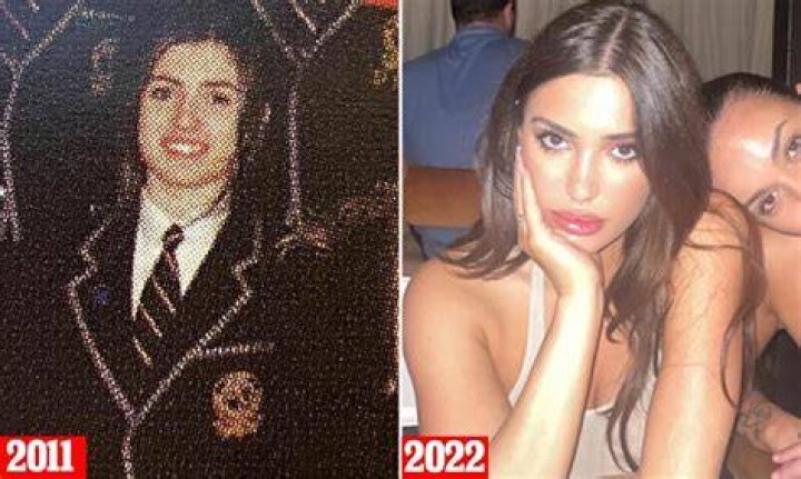 Has Bianca Censori Had Breast Surgery? Unveiling the Truth