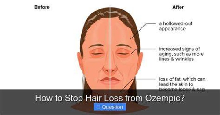 How to Stop Hair Loss from Ozempic: A Comprehensive Guide
