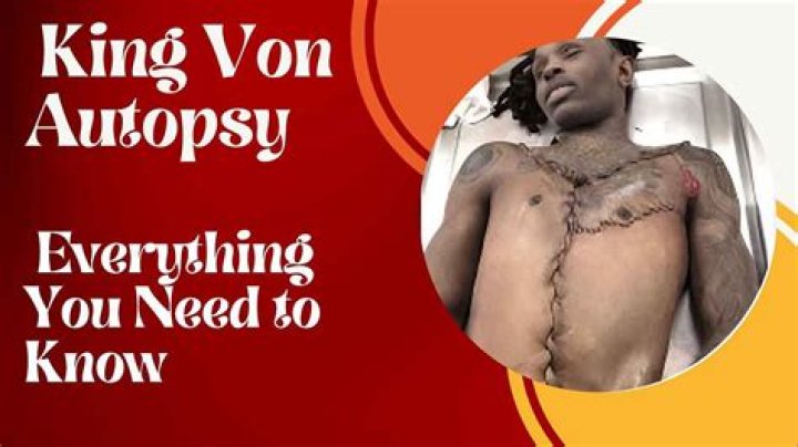 King Von Autopsy Picture: The Untold Story and What Fans Need to Know