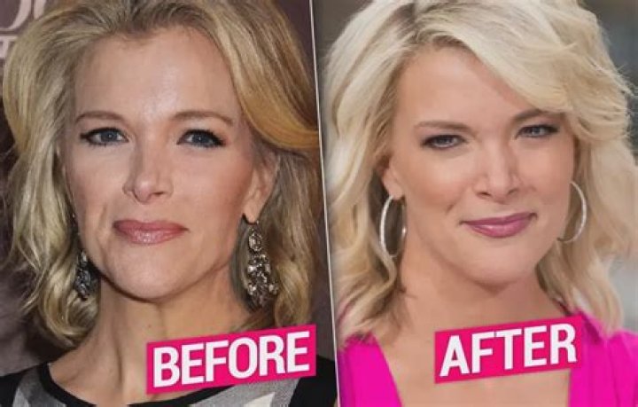 Megyn Kelly Before Weight Loss: A Comprehensive Look at Her Journey